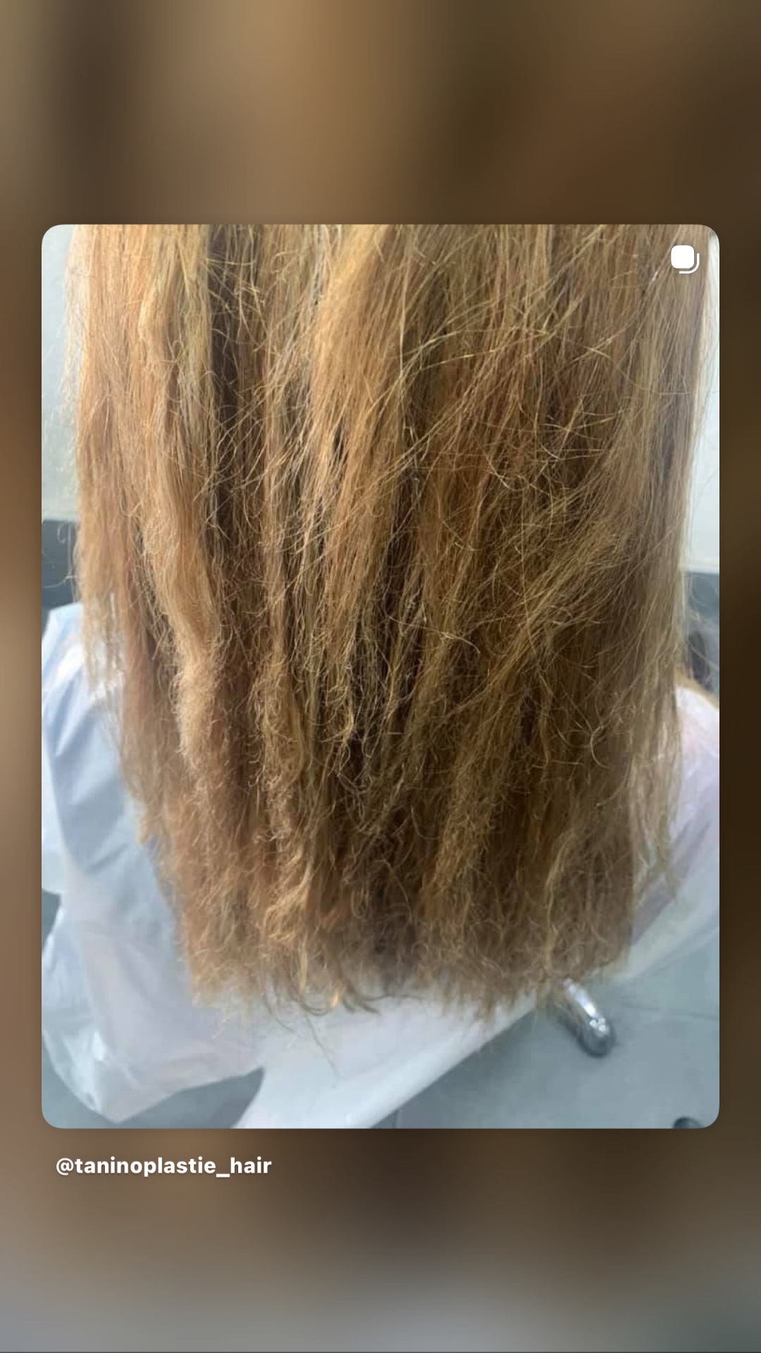 שיער לפני טיפול TANINOPLASTIE