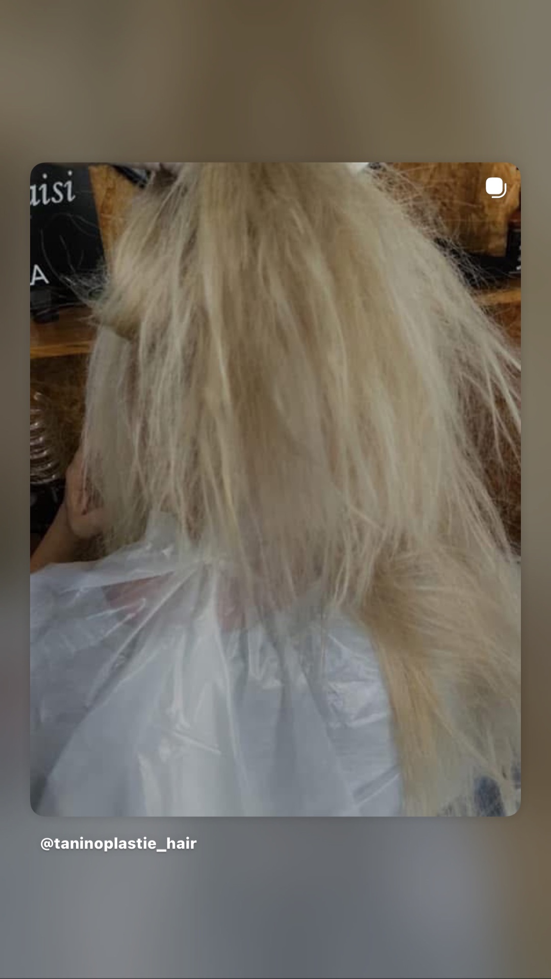 שיער לפני טיפול TANINOPLASTIE